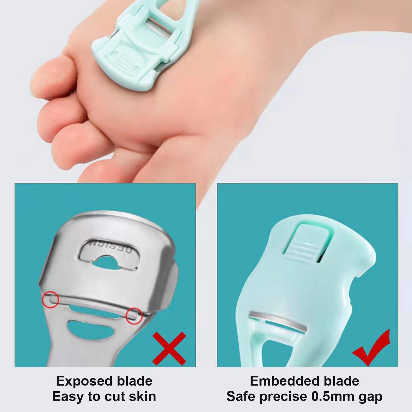 Foot Care Pedicure Callus Shaver Hard Skin Remover, Sichy Heel Scraper for Feet, 10 Replacement Slices 1 Stainless Steel Callus Shaver Foot Care Tools Beauty & Personal Care Sichy