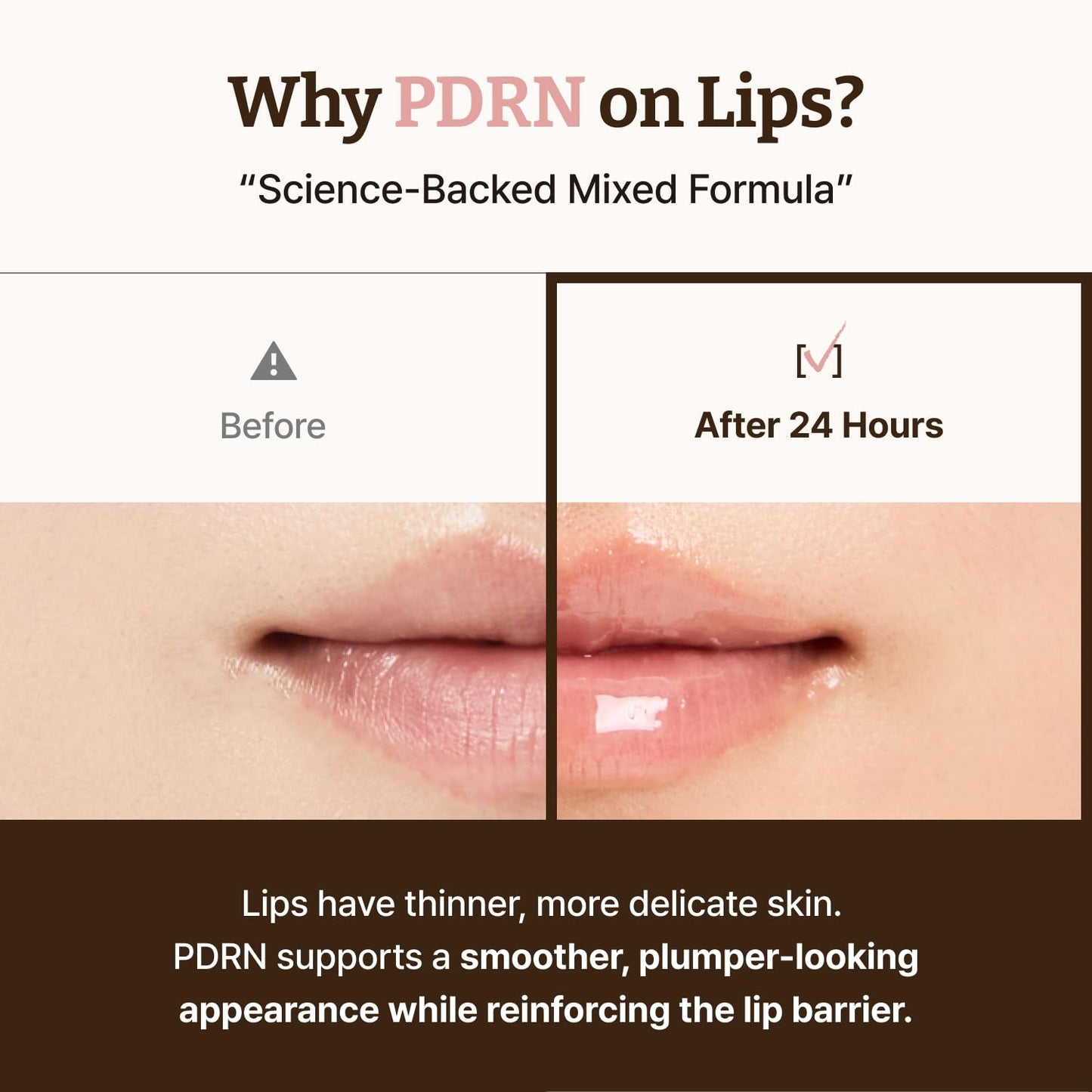 Dr.Reju-All Advanced PDRN Rejuvenating Lip Serum - Hydrating Lip Balm with Lipozip PDRN for Glowy, Dewy Lips - Gentle Exfoliating & Smoothing Lip Beauty and Personal Care Dr.Reju-All