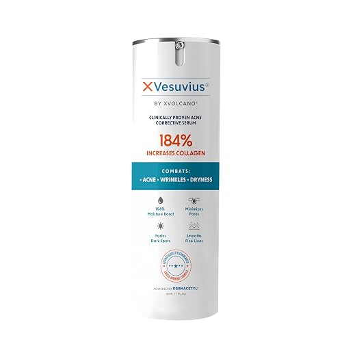 XVesuvius Acne Treatment Serum - Clinical Strength Formula with 2% Salicylic Acid & Retinol - Clears Breakouts, Fades Scars, Anti-Aging - 30ml (1 Beauty & Personal Care xvolcano
