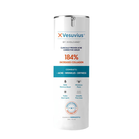 XVesuvius Acne Treatment Serum - Clinical Strength Formula with 2% Salicylic Acid & Retinol - Clears Breakouts, Fades Scars, Anti-Aging - 30ml (1 Beauty & Personal Care xvolcano
