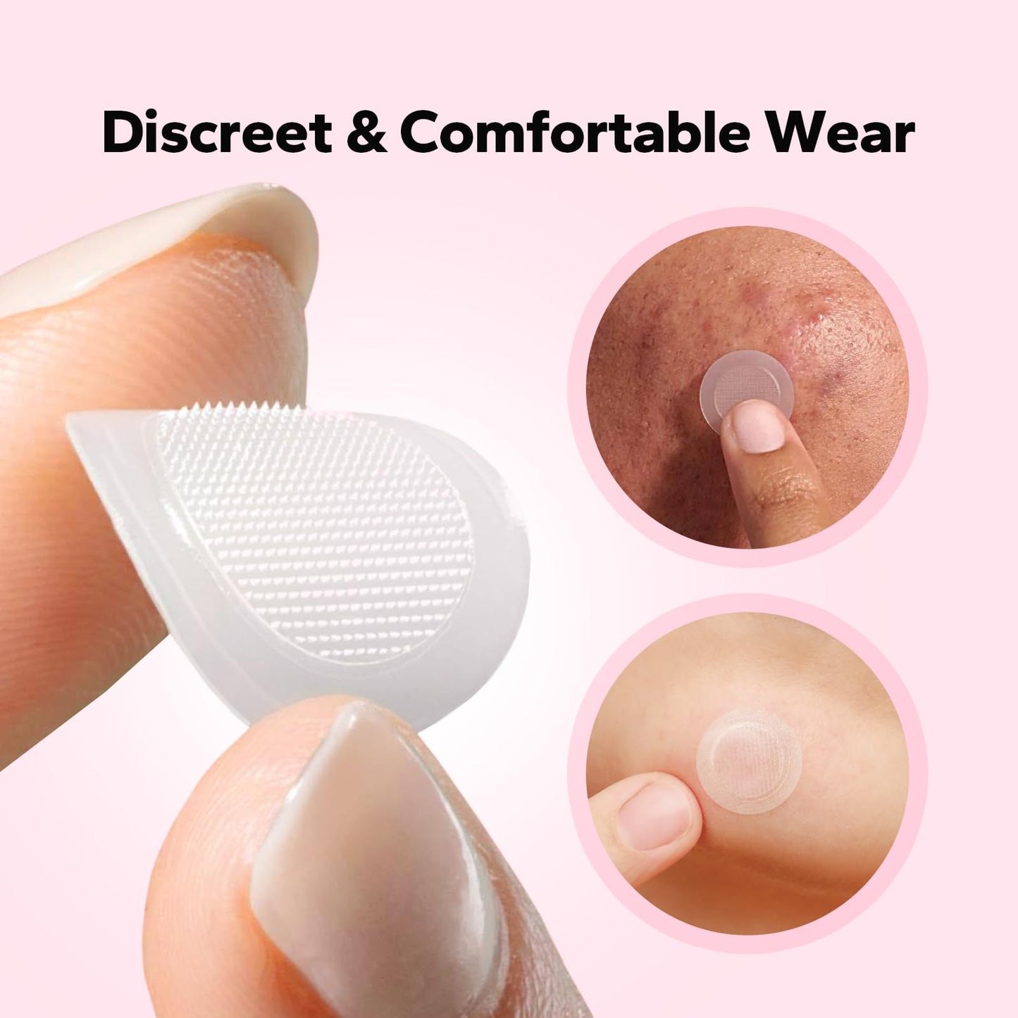 CharmCherry Pimple Patches for Face (18 Count), Microdart Acne Patches, Hydrocolloid Blemish Spot with Salicylic Acid, Fast-Acting for Early Stage Beauty & Personal Care CharmCherry