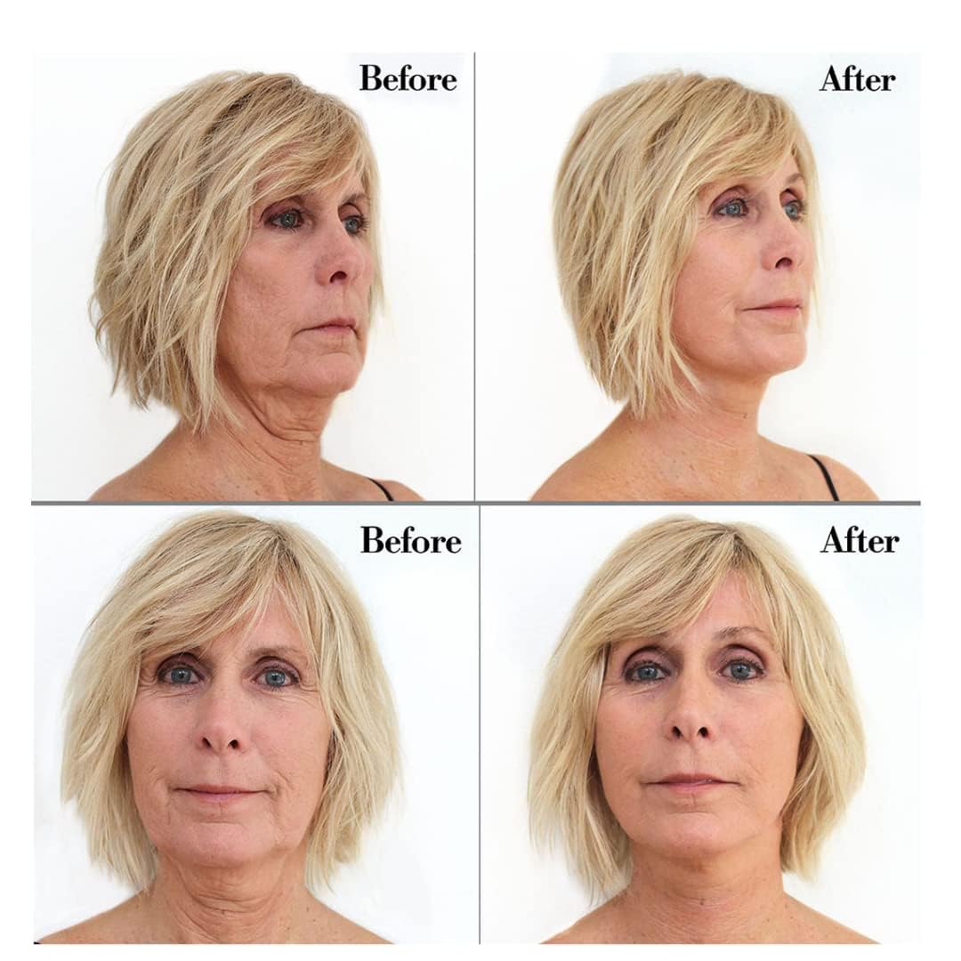 Bring It Up Instant Neck Lift Tape 30 Day Supply, Transparent Neck Lifting Anti Wrinkle Stickers - Tones Sagging Necklines Instantly - Made in USA Beauty & Personal Care Bring It Up