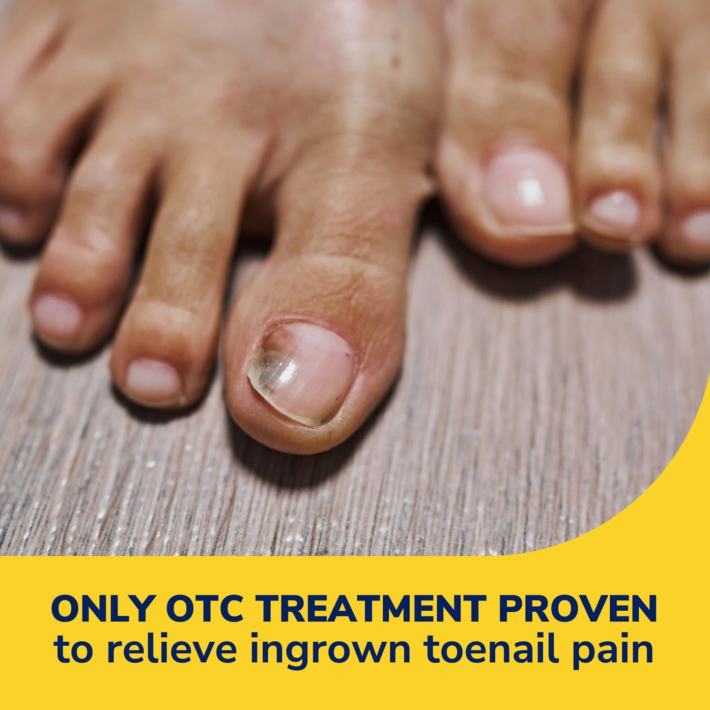 Dr. Scholl's INGROWN TOENAIL PAIN RELIEVER & TRIMMING KIT, 0.3 oz // Only OTC Treatment Proven to Relieve Ingrown Toenail Pain - Includes Medicated Beauty and Personal Care Dr. Scholl's