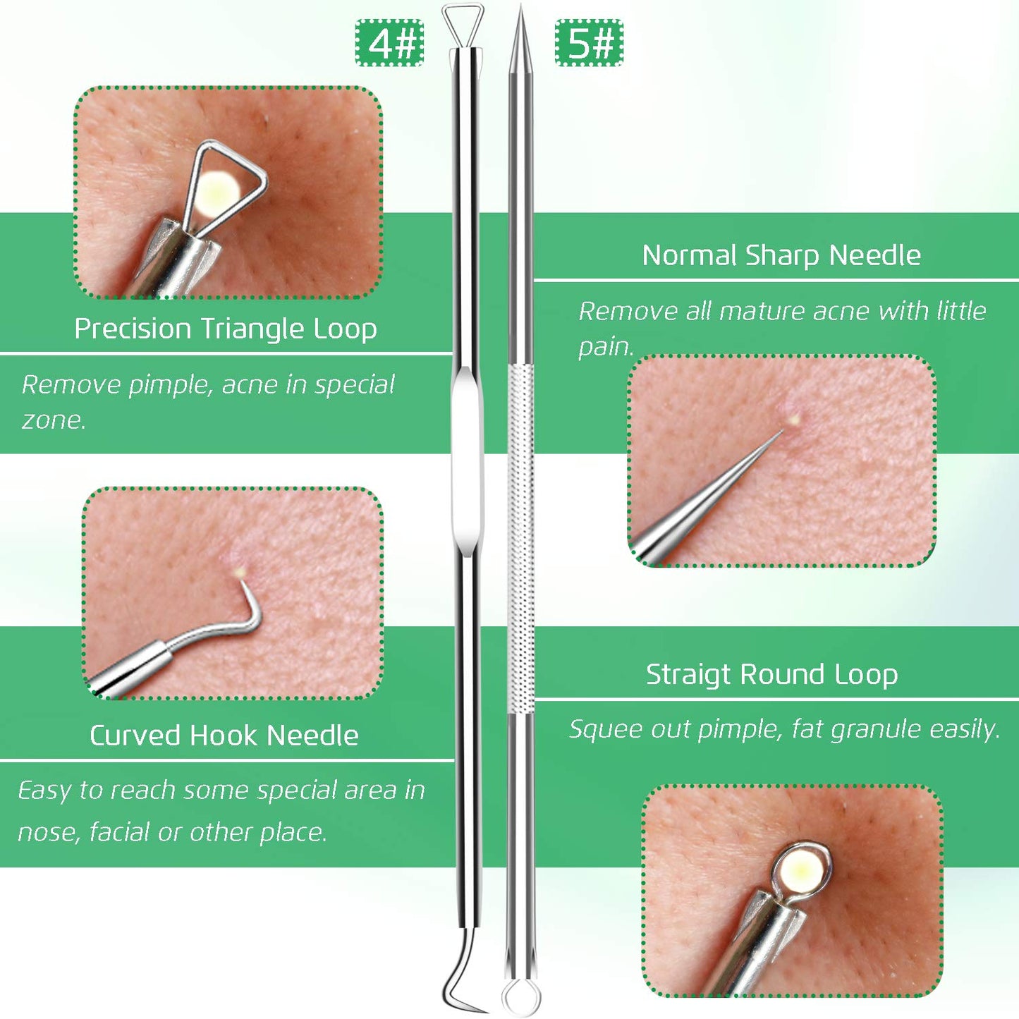 5PCS Blackhead Remover Comedone Extractor, Curved Blackhead Tweezers Kit, Professional Stainless Pimple Acne Blemish Removal Tools Kit for Manual Beauty & Personal Care UWOIST