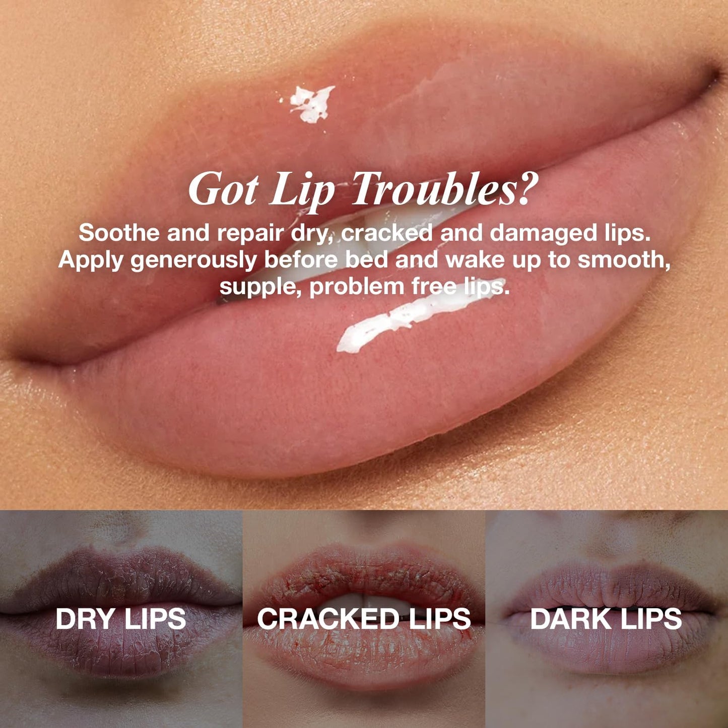 Lip Remedy Lip Balm 0.28oz Strawberry Scented Long-Lasting Hydration Repairs Dry Cracked Lips Overnight Moisturizing Formula (Strawberry, 3 Pack) Beauty and Personal Care STAR CARE