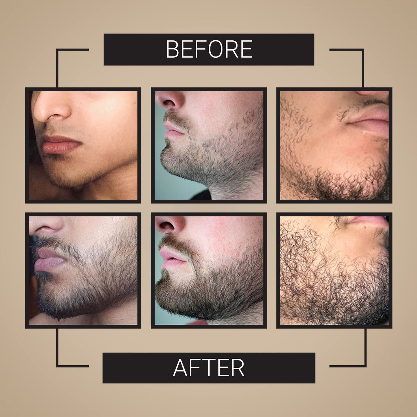 Crafted Beards Beard Growth Oil Serum - 1 fl Oz - Unscented - Helps Grow A Thicker Beard, Improves Beard Health, Fills in Thin and Patchy Spots - (1 Beauty and Personal Care Crafted Beards