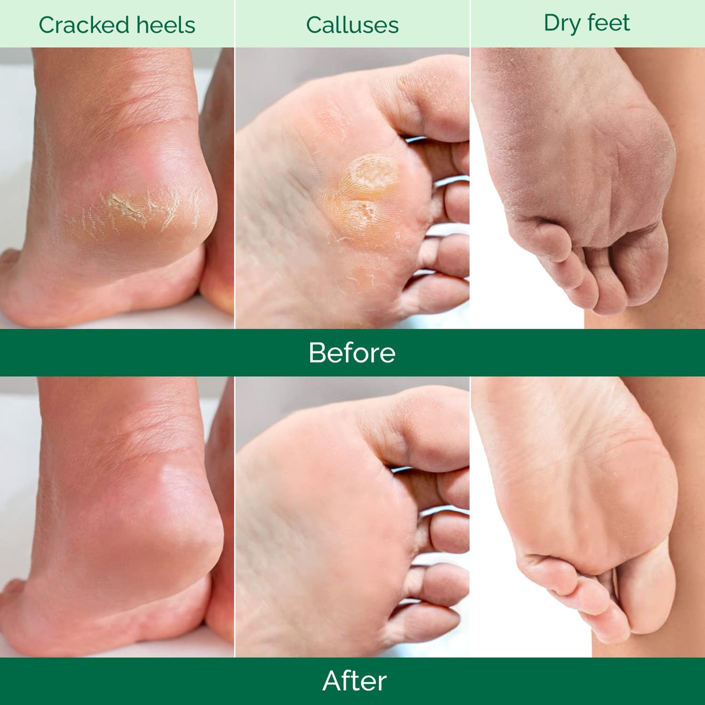 PLANTIFIQUE Foot Peeling Mask 2 Pack for Men | Dermatologically Tested Repairs Heels & Removes Dry Dead Skin for Baby Soft Feet | Exfoliating Foot Beauty and Personal Care PLANTIFIQUE