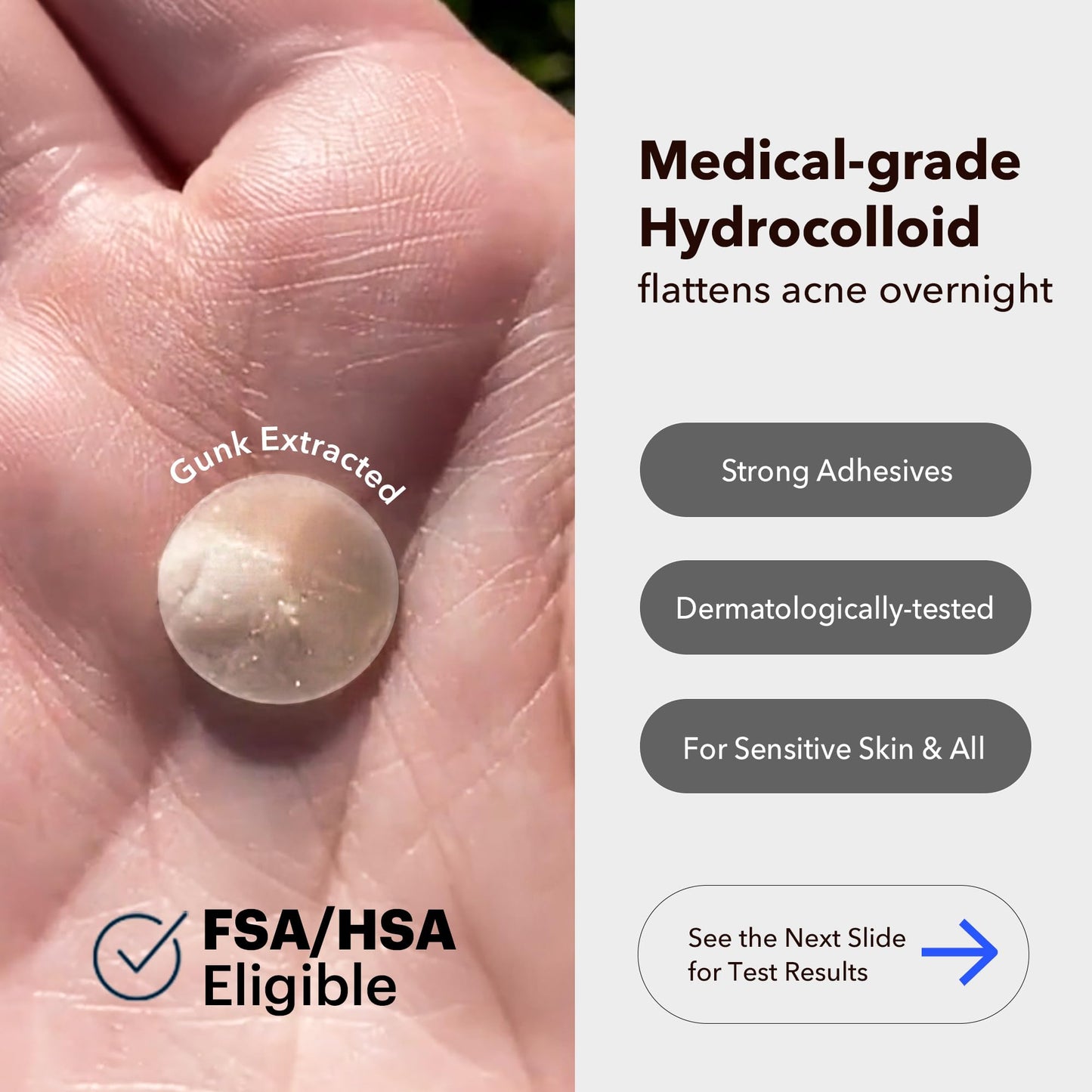 AVARELLE Pimple Patches for Face | Hydrocolloid Acne Patches for Covering Blemishes | FSA HSA Store Eligible Zit Patches with Tea Tree, Calendula Beauty and Personal Care AVARELLE