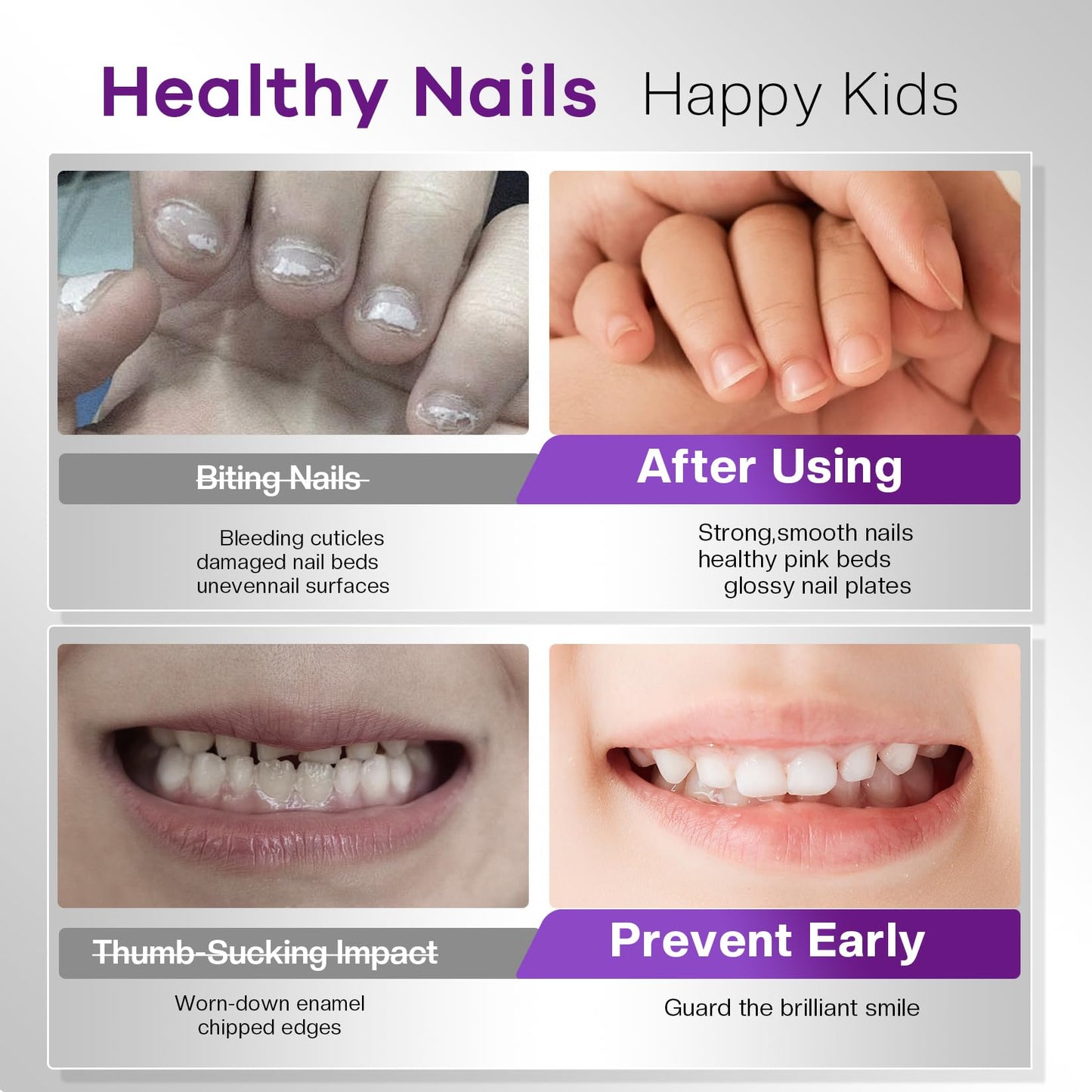 Glamonade Stop Nail Biting Polish Extra Strength Formula Upgraded Bitterness Effective Anti-Biting Treatment for Adults Kids Bitter Nail Deterrent Beauty and Personal Care Glamonade