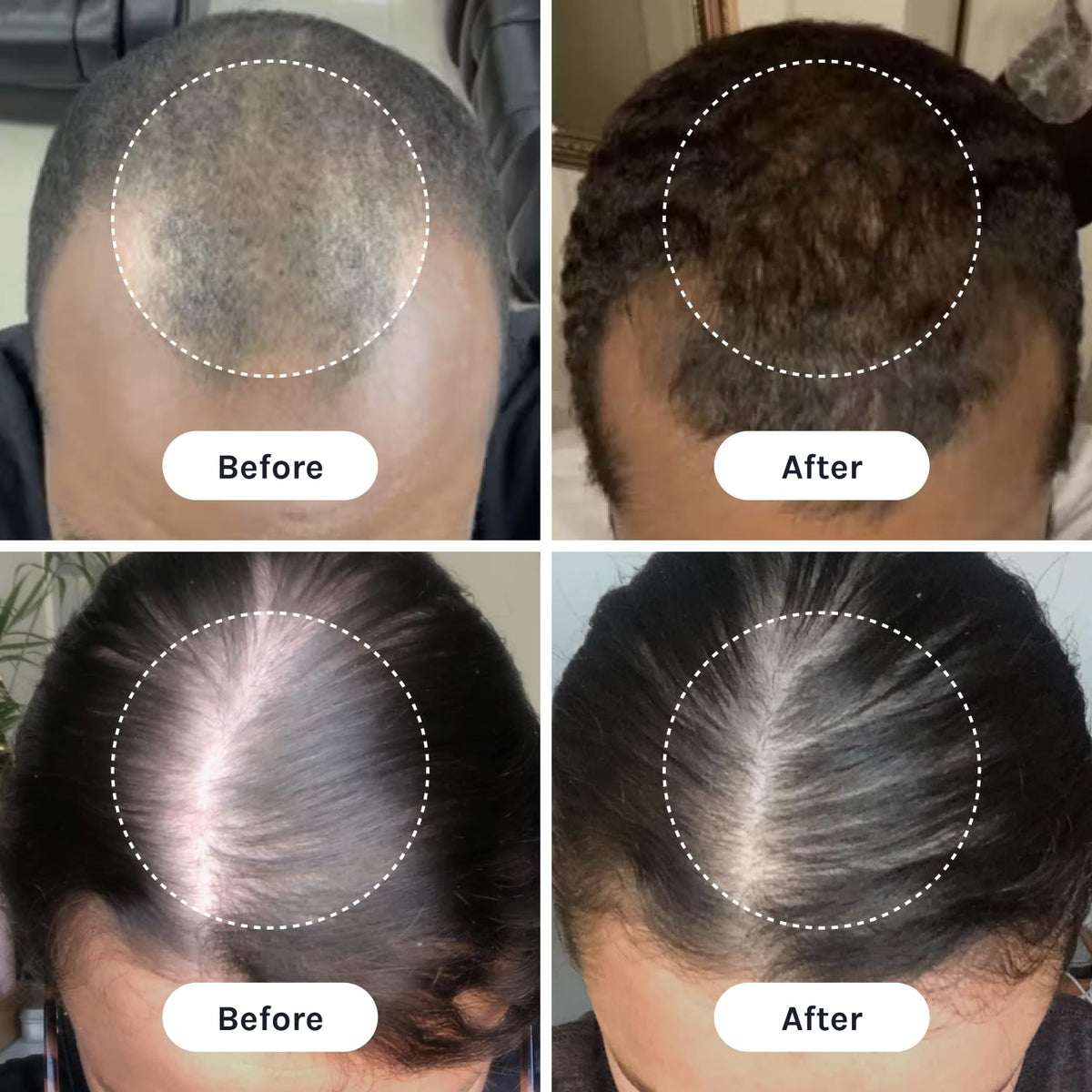 InfiniWell Duo - Scalp & Hair Serum for Hair Growth - Encourage Visible Fullness - Physician-Formulated - Nourish Follicle Health & Support the