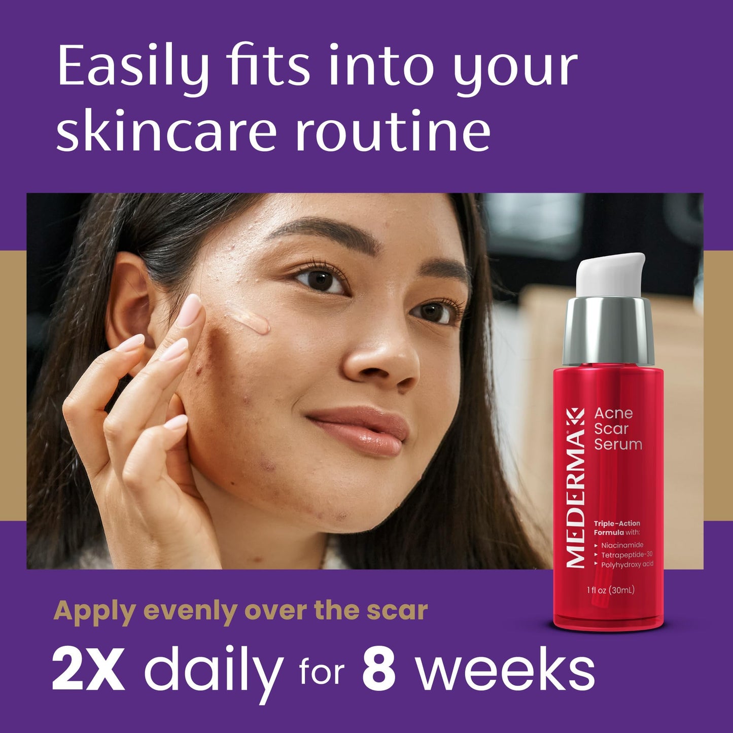 Mederma Acne Scar Serum Triple-Action Formula with Niacinamide, Tetrapeptide-30, and Polyhydroxy acid Clinically Shown to Lighten Acne Scars, 1 Fl Beauty & Personal Care Mederma