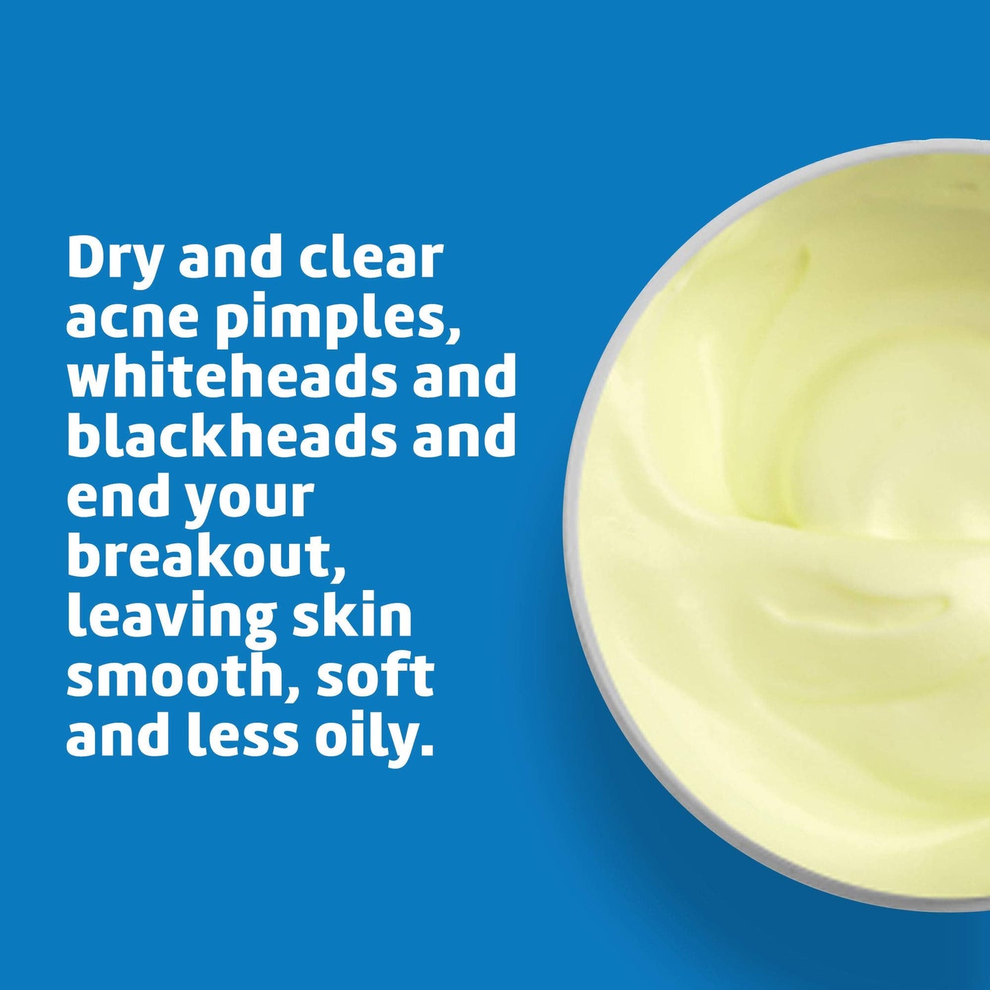 De La Cruz Sulfur Ointment - Cystic Acne Treatment for Face and Body - Daily 10 Min Spot Treatment Mask - Safe and Effective Game Changing Hormonal Beauty and Personal Care De La Cruz