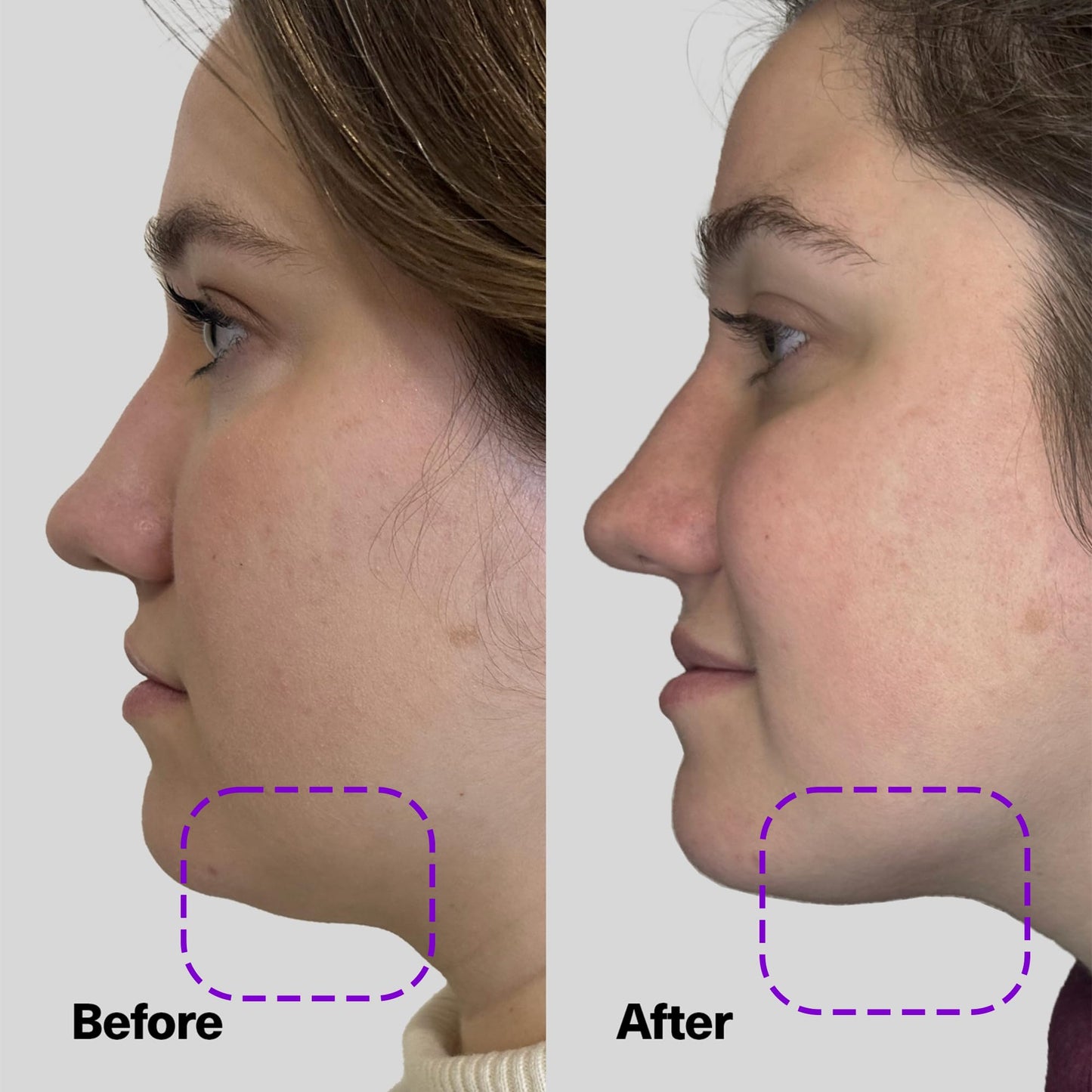 SickScience ShapeShift Advanced Jaw & Neck Firming Serum - Double Chin Reducer, Face Tightening Treatment with Exosome Technology to Lift Sagging Skin Beauty & Personal Care SickScience