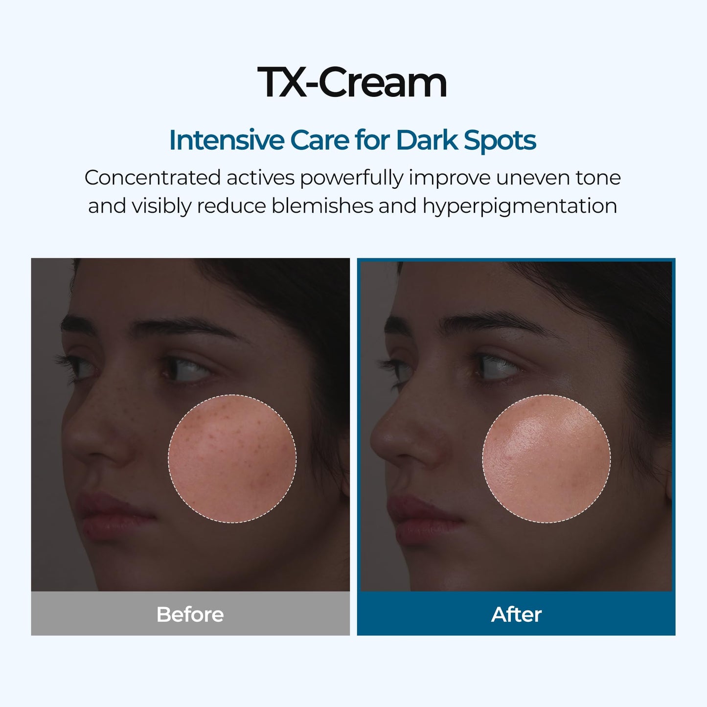 DR.Melaxin TX Tranexamic Acid CREAM | Skin freckle Cream, Blemishes, Anti-pigmetation korean skin care | Korean Cosmetics | 1.7 fl oz (50 ml) Beauty and Personal Care Dr.Melaxin