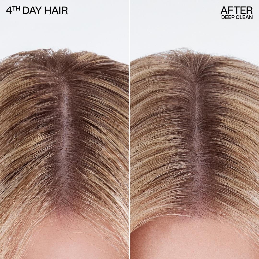 Redken Deep Clean Dry Shampoo - For Oily Hair, 10.5 Fl Oz
