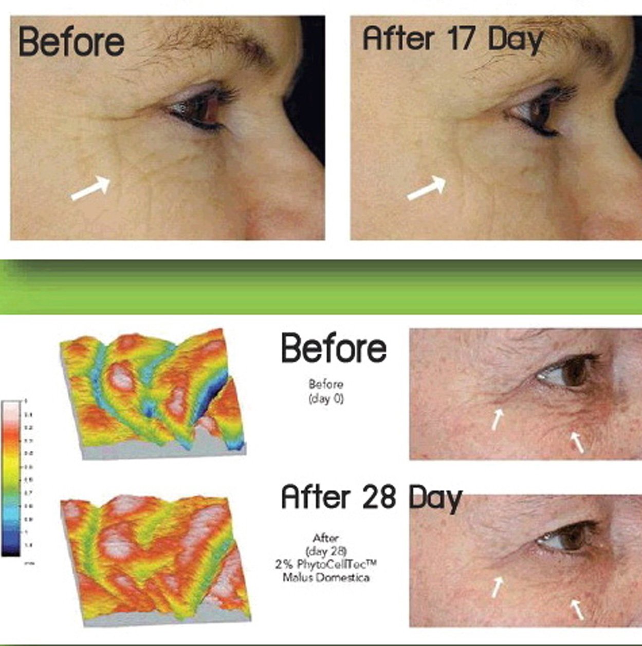 Anti-Aging. DIY Swiss Apple Stem Cell 100% Serum Booster. Remove Wrinkles, Rebuild Collagen & Elastin Beauty & Personal Care DNA Code