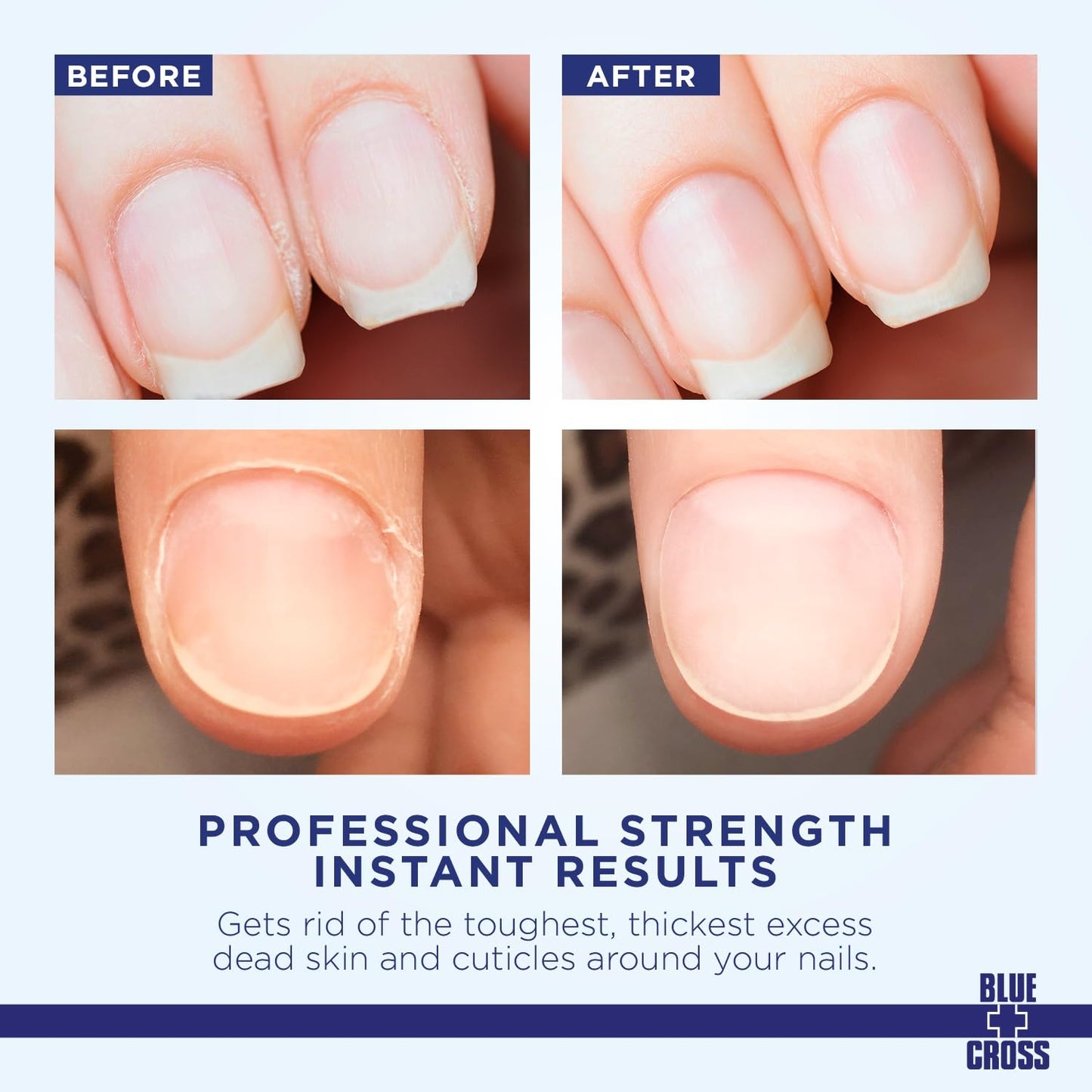 Cuticle Remover & Softener Liquid for Nails - Blue Cross Professional Nail Care with Lanolin, Hydrating Treatment for Dry Cuticles & Hangnails, Made Beauty and Personal Care Blue Cross