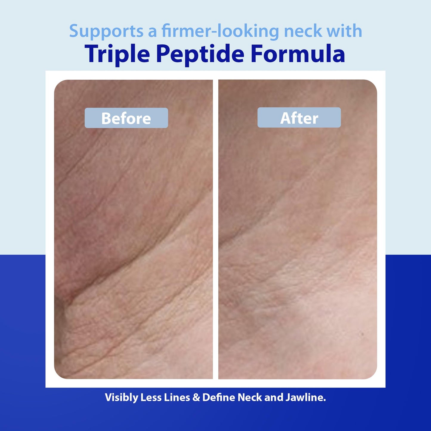 Dr. Denese Triple Strength Neck Wrinkle Smoother 4 oz - Firming Cream with Triple Amount of Peptides Compared to Industry Standards - Retinol Beauty & Personal Care Dr. Denese