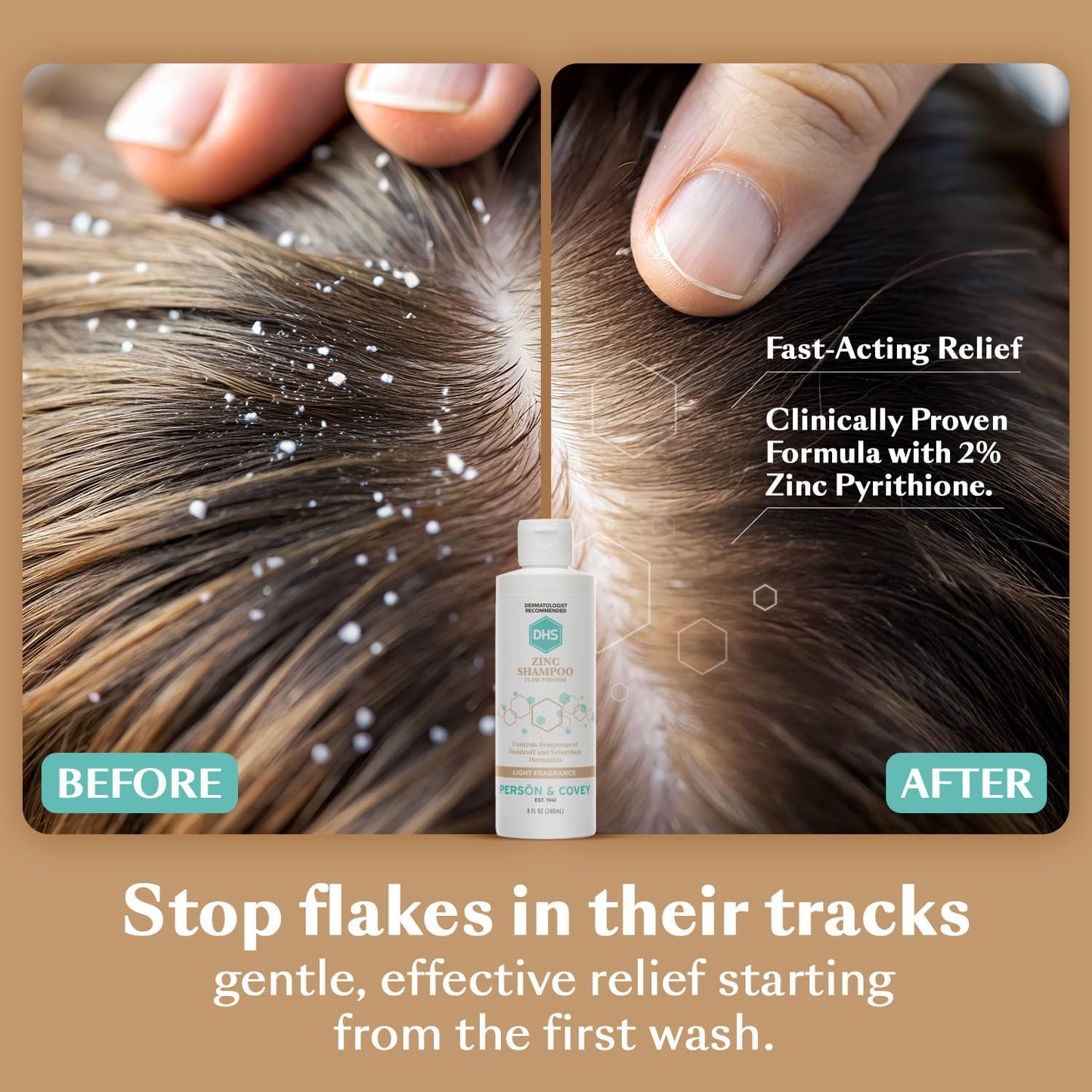 DHS Zinc Shampoo - Dandruff Shampoo - for Flaky and Dry Scalp with 2% Zinc Pyrithione, 8 oz Beauty & Personal Care DHS