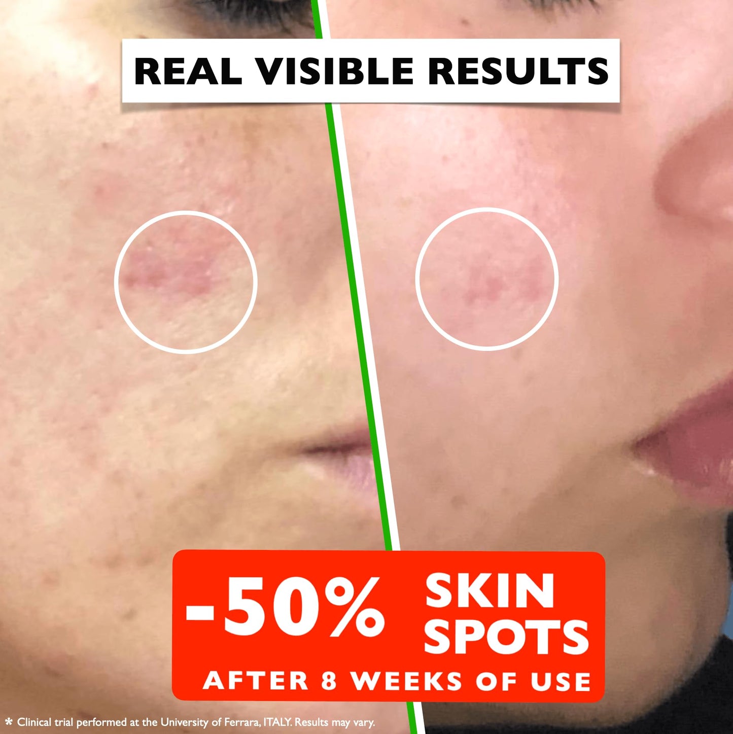 Vitamin C Serum For Face - Anti Aging Face Serum with Vitamin C, Hyaluronic Acid, Vitamin E. Brightening Formula. Improve Appearance of Dark Spots Beauty & Personal Care Florence