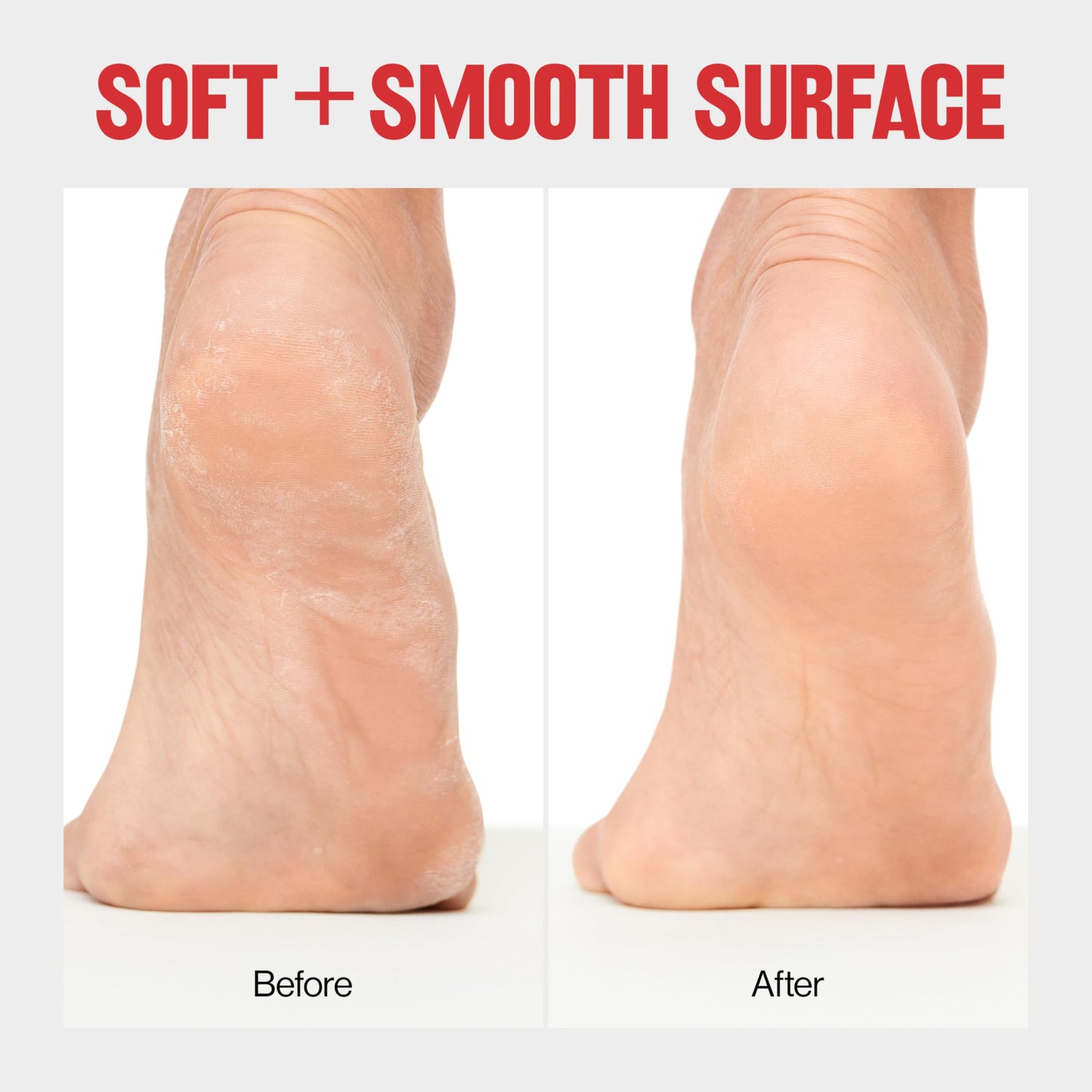 Revlon Callus Remover, Foot File with No-Mess Cover, Gently Exfoliates and Smooths Feet, Softens Calloused Areas, Stocking Stuffer for Women, 1 count Beauty & Personal Care REVLON