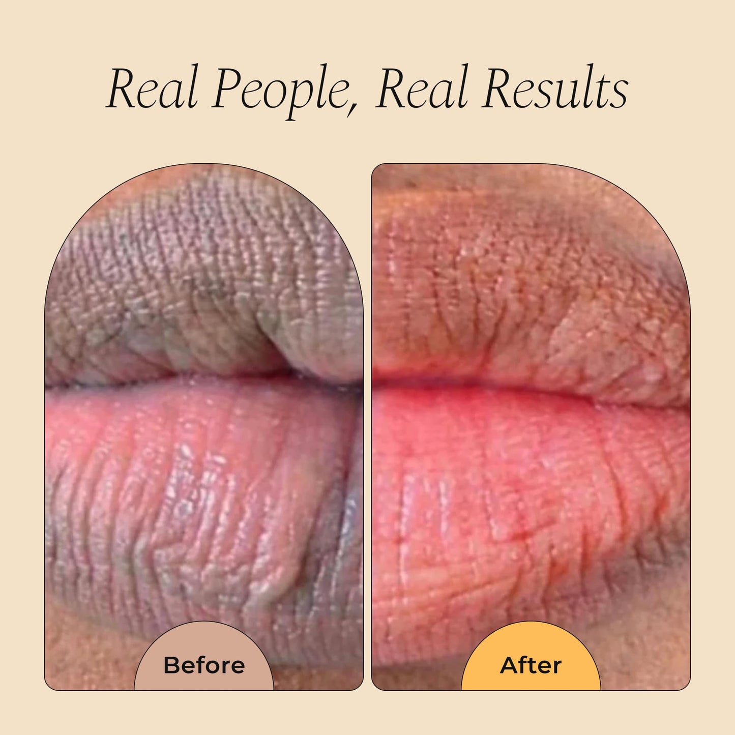 Glo Melanin All Natural Lemon and Turmeric Lip Balm - Natural Lip Balm Illuminate Your Smile, Brighten & Nourish Dark Lips Effortlessly - For Smokers Beauty and Personal Care Glo Melanin