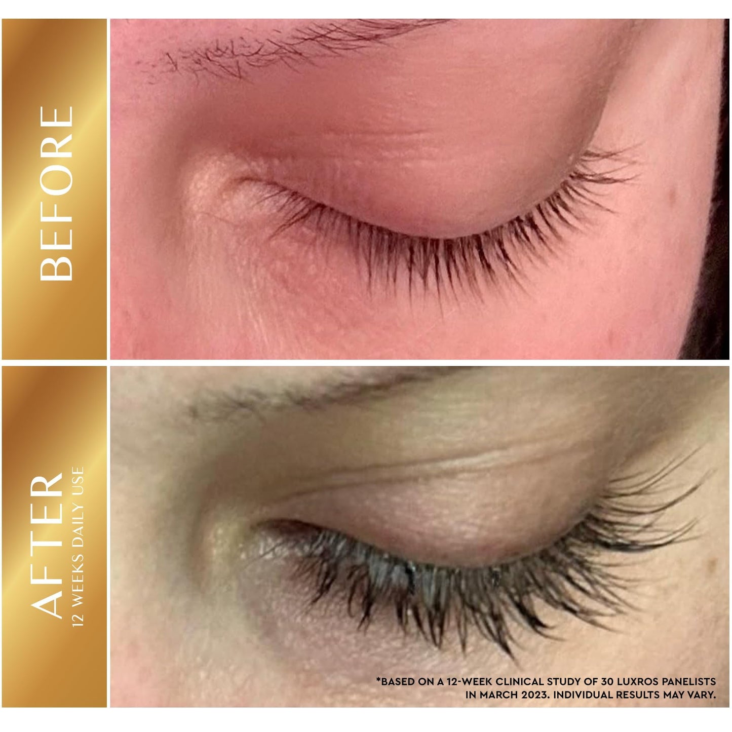Eyelash Growth Serum 5 mL: Get Thick, Strong Lashes in Just 3-4 Weeks with Our Plant-Based Eyelash Growth Serum - No Parabens - Made in USA Beauty & Personal Care LUXROS