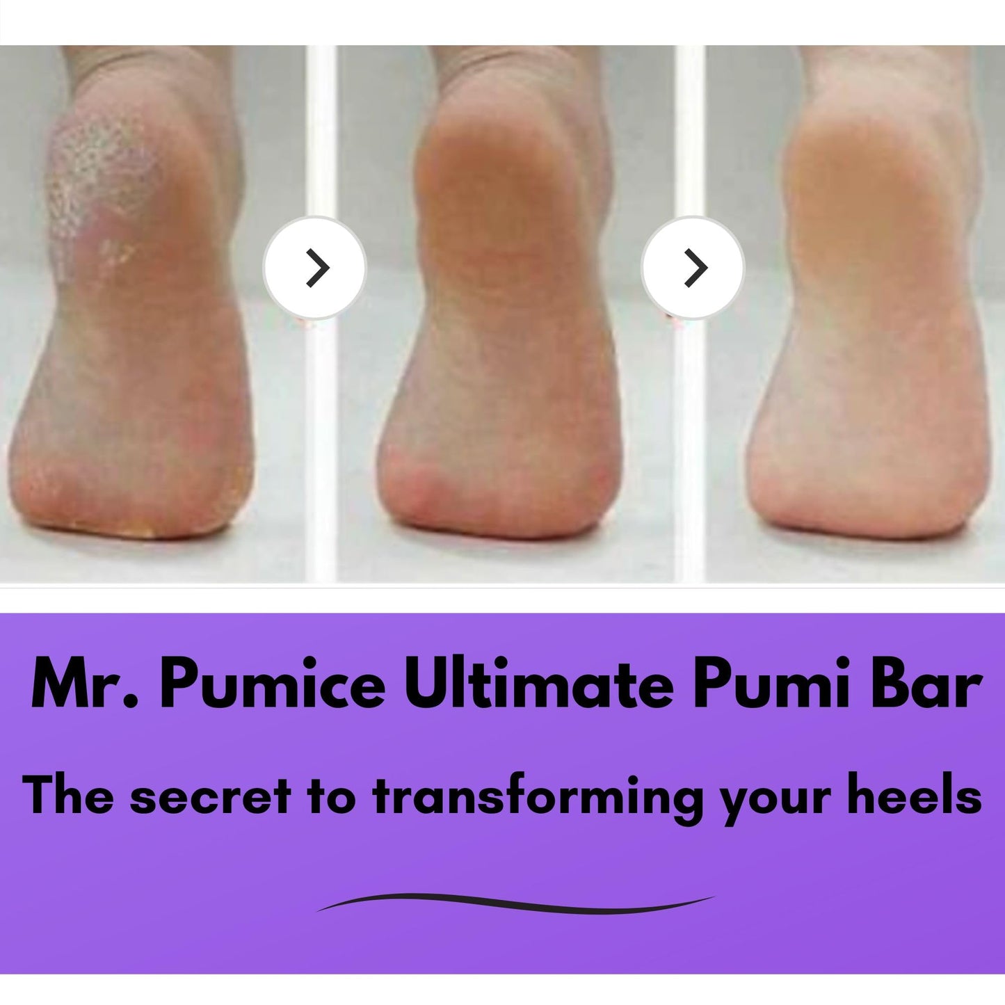 Mr. Pumice Ultimate PUMI Bar 2-in-1 Dual Grit (Medium + Coarse) Callus Remover, Pedicure Stone & Ped File Scrubber for Smooth Feet and Heels (4 Pack) Beauty and Personal Care Mr. Pumice