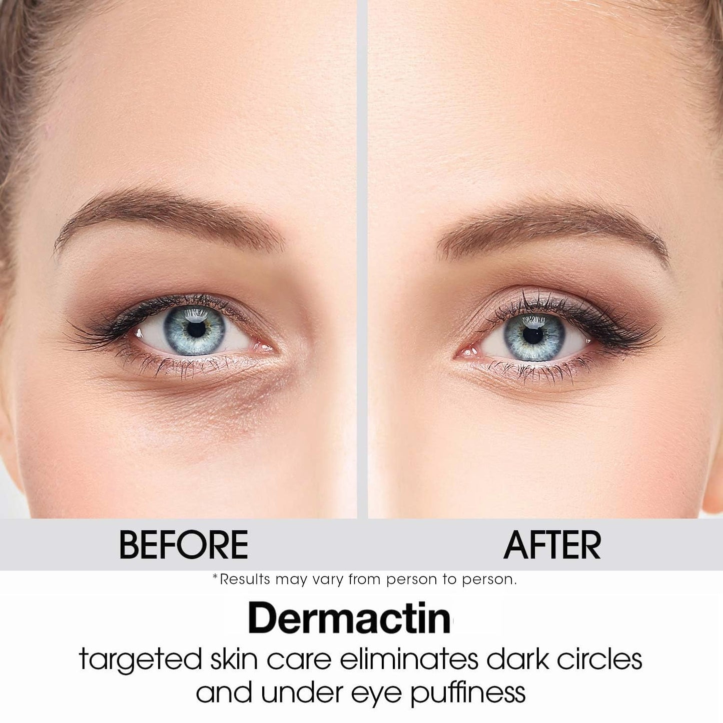 Dermactin Upper Eyelid Cream 1 oz – Firms & Tones Drooping Lids for a Youthful, Vibrant Look | Gentle Formula for Sensitive Eyelid Skin Beauty & Personal Care Dermactin