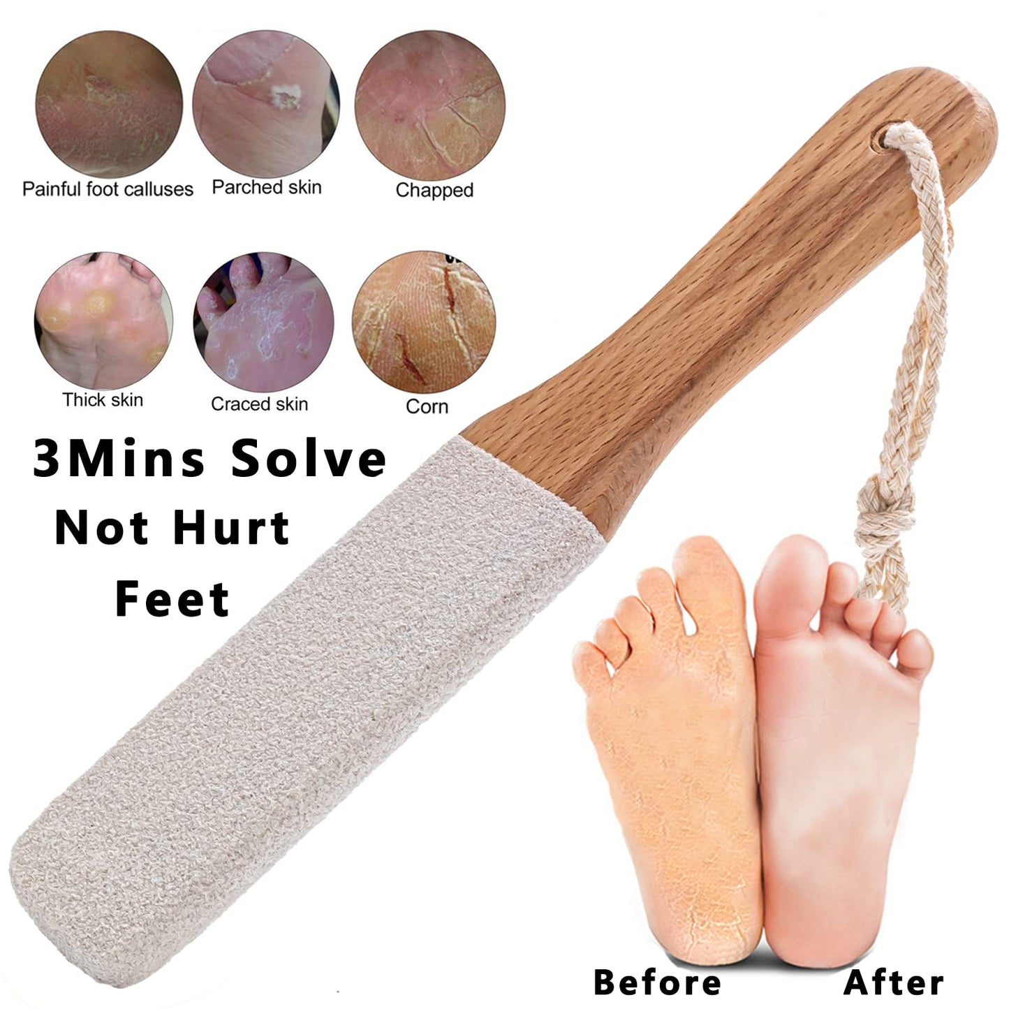 Kinepi Callus Remover Foot Scrubber Colossal Foot File Foot Care and Foot Exfoliator Foot Rasp Pedicure Tools Pumice Stone for Feet,Remove Corn Hard Beauty & Personal Care Kinepi