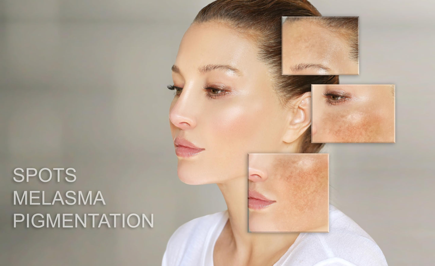 MT Skin Clinic Day Cream Moisturizer for Face Hydration Skincare for Sensitive Skin Acne Treatment and Redness Reducing Moisturizing Facial Cream Beauty & Personal Care MT SKIN CLINIC