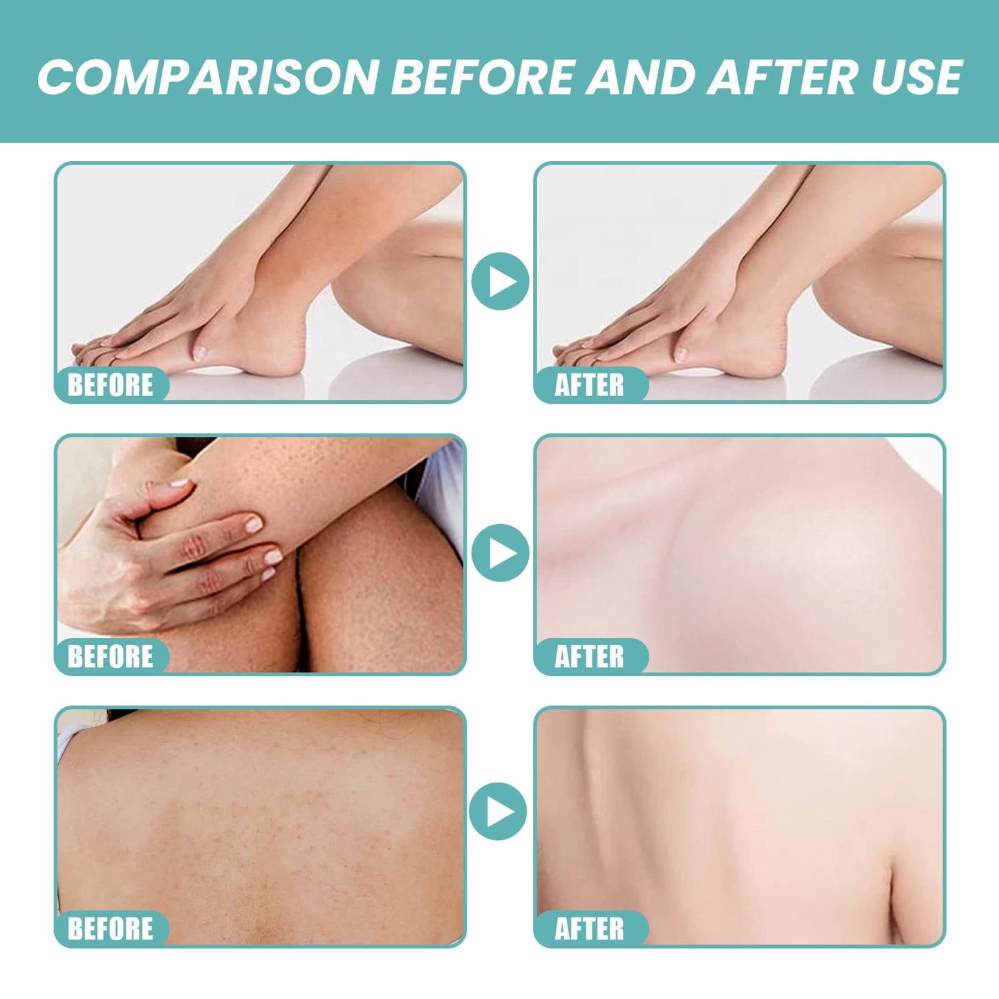Skin Bath Oil So Soft Sensual,Bath Oil,Skin So Soft Oil,Skin Moisturizing Smoothing & Softens Dry or Rough Skin (1PC) Beauty and Personal Care PONNYC