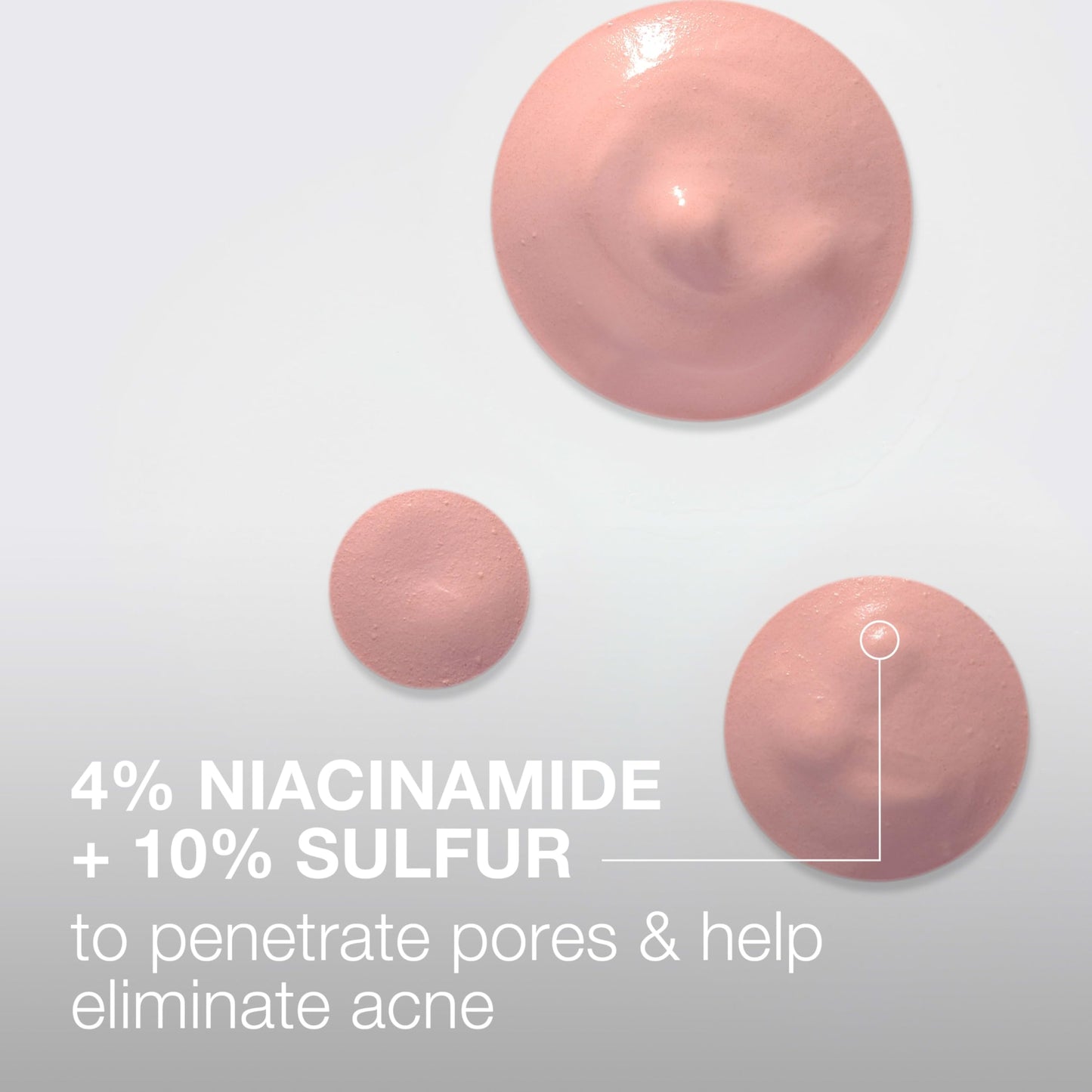 Neutrogena Stubborn Acne Spot Drying Lotion, Fragrance-Free Sulfur Acne Treatment Clears Acne By Drying Up & Shrinking Pimples, Paraben- & Oil-Free Beauty & Personal Care Neutrogena
