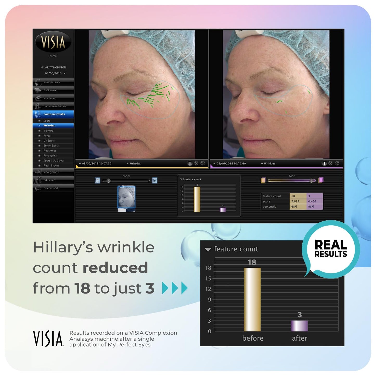 My Perfect Eyes by Penny Lane | Anti-Aging Eye Cream for Dark Circles & Puffiness | Instant Firming Treatment for Wrinkles & Fine Lines | Undereye Beauty & Personal Care My Perfect