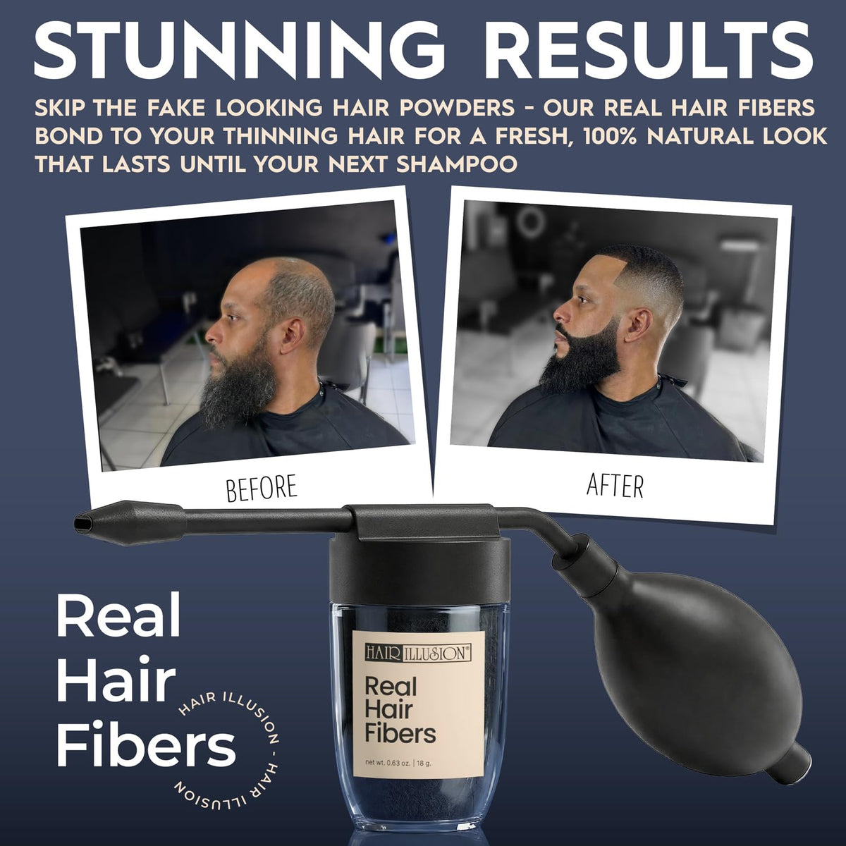 Hair Illusion Spray Applicator Removable Flat Tip designed to Spray Precise Hairline or Remove Tip For Round Sprayer And Wide Coverage (does not
