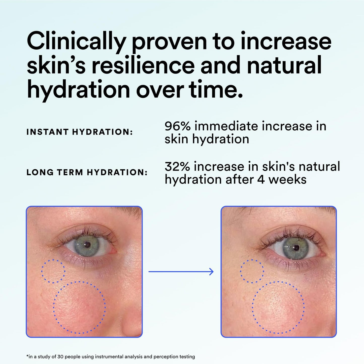 Experiment Super Saturated Ultra Hydrating Barrier Serum - 30% Glycerin, Polyglutamic Acid + Prickly Pear for Intensive Moisture, Plump + Dewy Skin Beauty and Personal Care Experiment