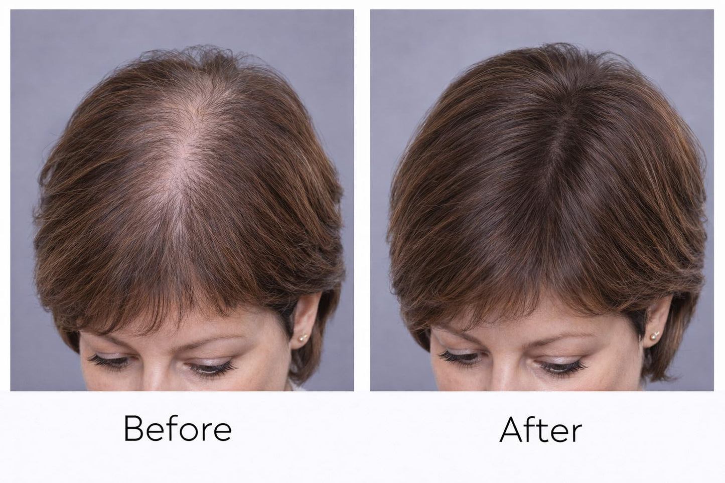 diCesare NEW! 2-n-1 Thicken Natural Hair Builder Dark Brown Custom Formulation Covers Thinning Areas and Attaches to Existing Hair Appearing Thicker Beauty & Personal Care DICESARE