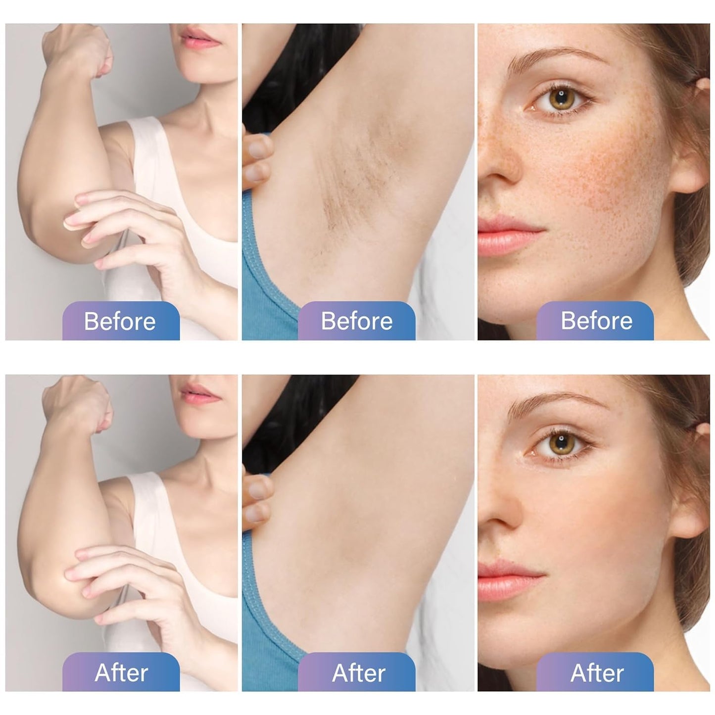 Dark Spot Corrector Serum for Face & Body: Niacinamide, Alpha-Arbutin & Vitamin C Formula for Uneven Skin Tone, Sun Spots, Age Spots, Melasma Beauty & Personal Care ZAYUU