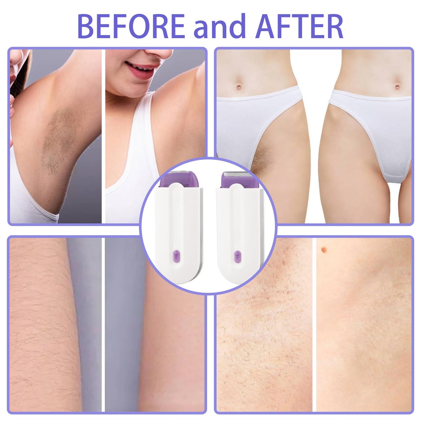 KAILIYA Focusing Silky Smooth Hair Removal Portable Painless Epilator Smooth Touch Hair Remove Applicable to Any Part of Women & Men's Body 1 PCS Beauty and Personal Care KAILIYA