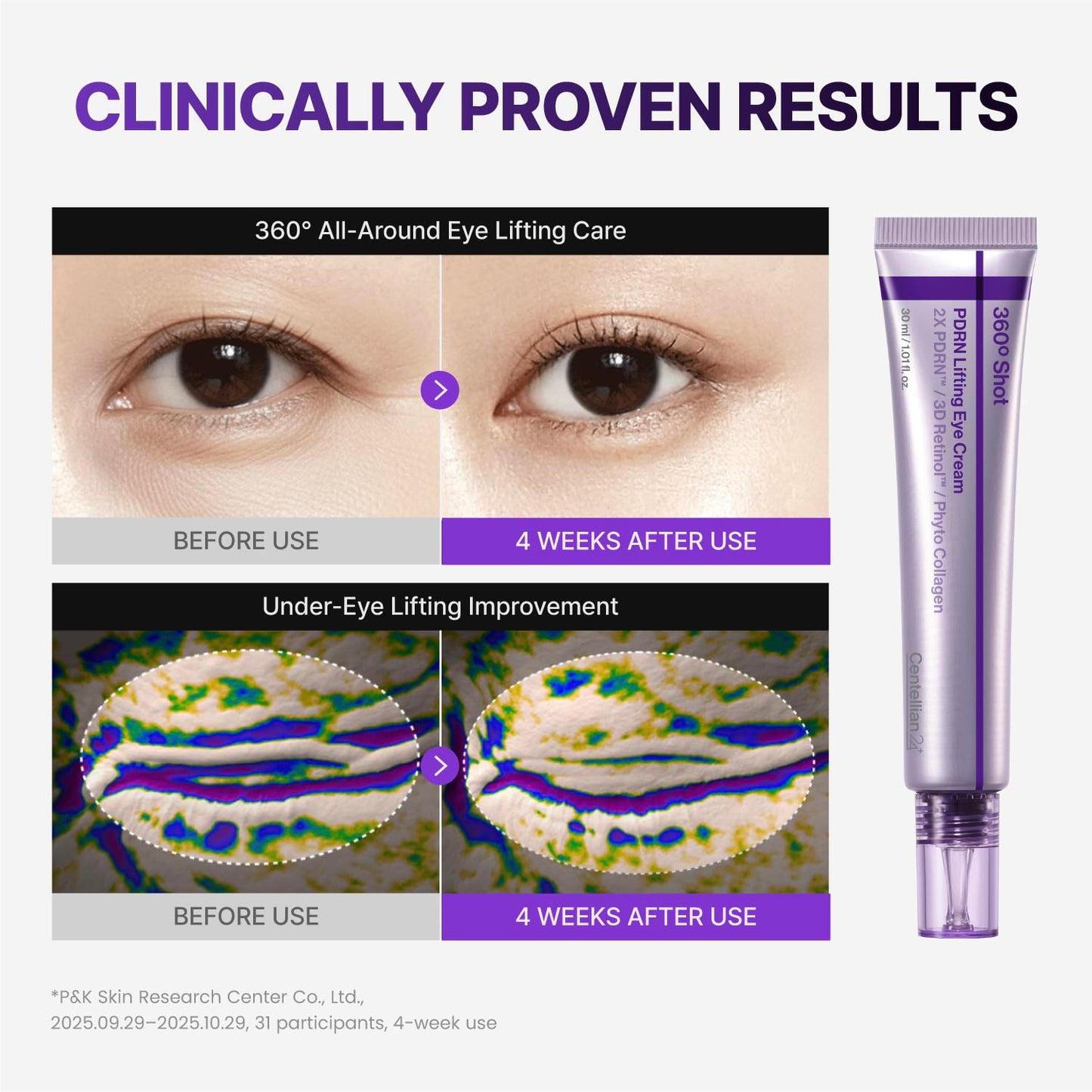 CENTELLIAN 24 PDRN Face & Eye Set (4pcs) - PDRN Cream 1.69 fl oz + Eye Cream 1.01 fl oz + Eye Patches (1pair x 2ea) + Active Serum 1.69 fl oz, TECA Beauty and Personal Care CENTELLIAN 24