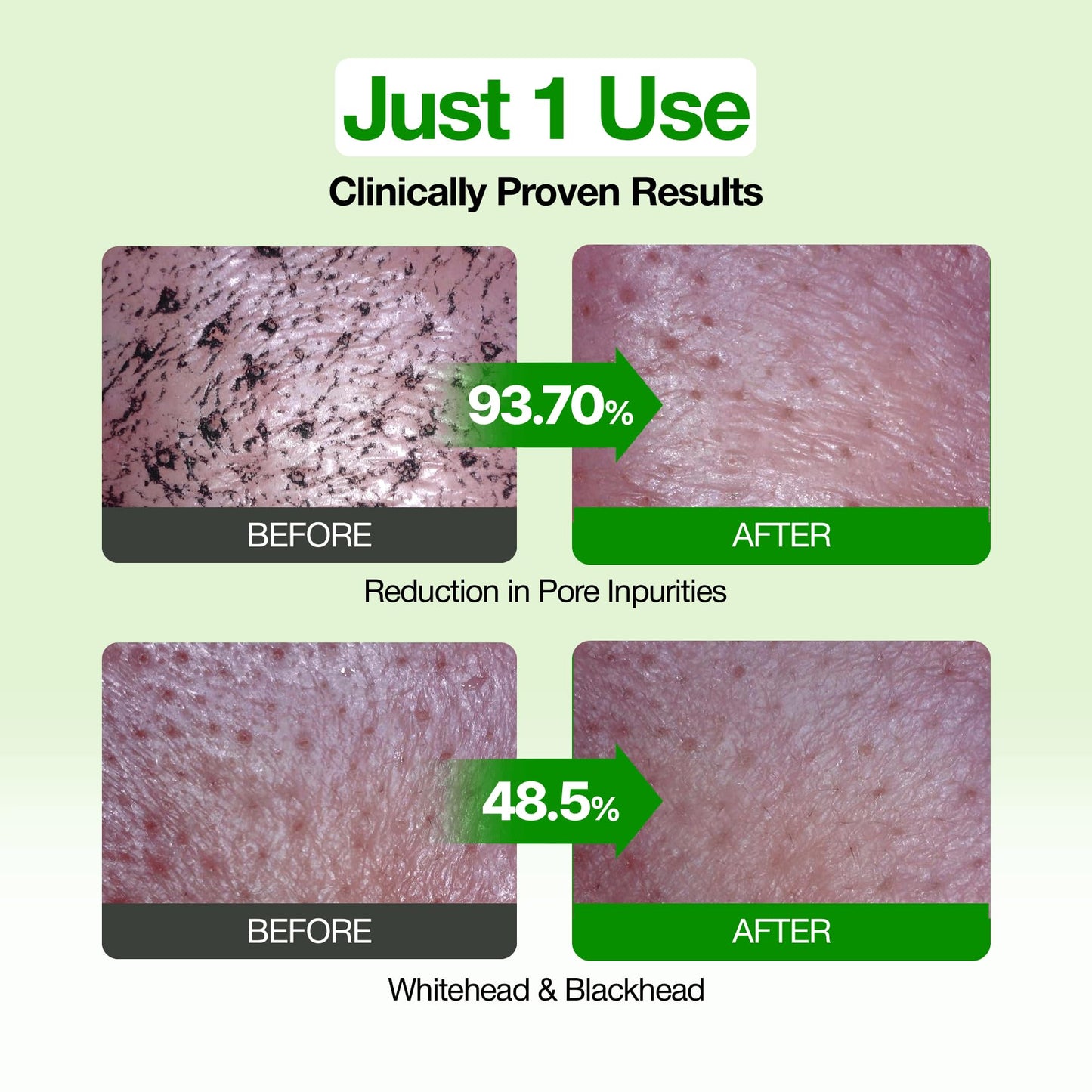 FULLY Green Tomato Pore Cleanser, Cardi B’s Clay Mask Cleanser for Deep Pore Cleanse & Pore Minimizer, Blackhead & Sebum Control, Gentle Face Wash Beauty and Personal Care FULLY