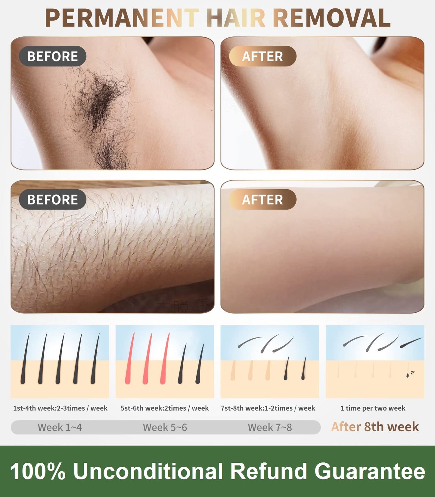 IPL Laser Hair Removal Device for Women and Men - Permanent Painless 90% Hair Reduction in 4 Weeks, Whole Body Use (Armpits, Bikini Line, Face, Legs Beauty and Personal Care Gransumr