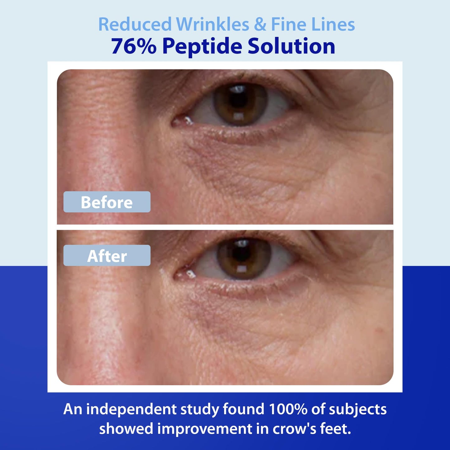 Dr. Denese Wrinkle RX 76% Peptide Solution Concentrate 1 oz - Supports Smoother, Firmer-Looking Skin With Lightweight Hydration - Doctor-Developed Beauty & Personal Care Dr. Denese
