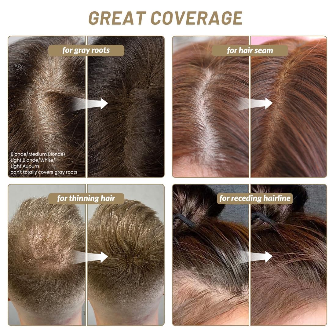 SOVONCARE Hairline Powder - Root Touch Up & Gray Hair Concealer for Men and Women, Instantly Covers Thinning Hair and Bald Spots, Natural-Looking Beauty and Personal Care SOVONCARE