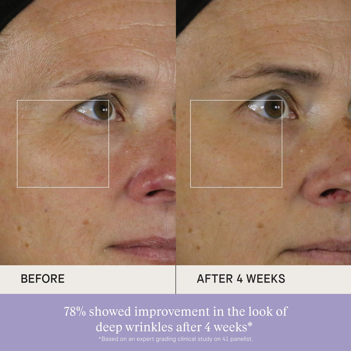 TATCHA The Silk Serum, Wrinkle-Smoothing Retinol Alternative with Hadasei-3