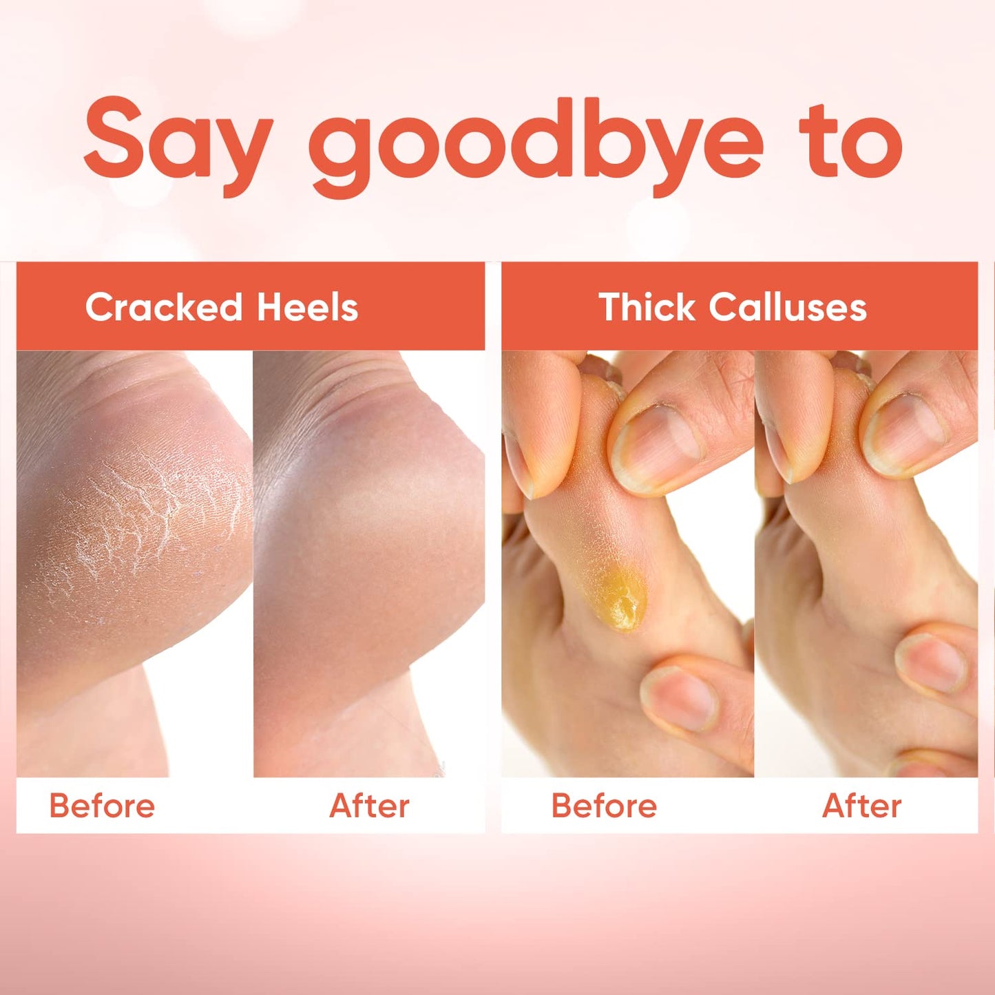 CÉLOR Foot Peeling Mask for Dry Cracked Feet | Foot Mask to Exfoliate Rough, Cracked, Dry Feet, Calluses for Soft Baby Feet Results | Made with Aloe Beauty and Personal Care CÉLOR