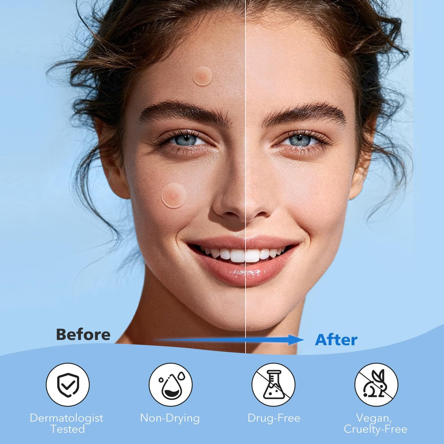 QUSTERE Pimple Patches for Face, Hydrocolloid Acne Patches, Cute Round Shape Zit Covers, Spot Stickers with Tea Tree, Salicylic Acid & Cica Oil| 2 Beauty & Personal Care QUSTERE