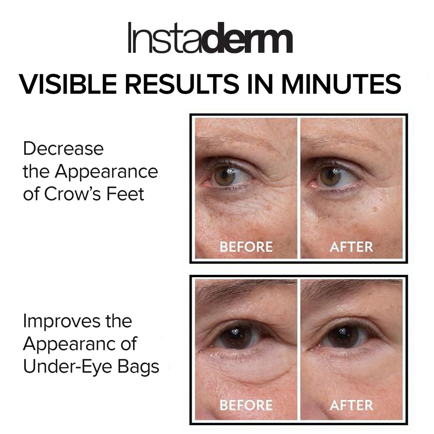 Instant Eye Tightener - Removes Under Eye Bags & Puffiness. Eliminate Dark Circles & Wrinkles. Naturally Ageless Hydrating Cream. Disappears Before Beauty & Personal Care Instaderm