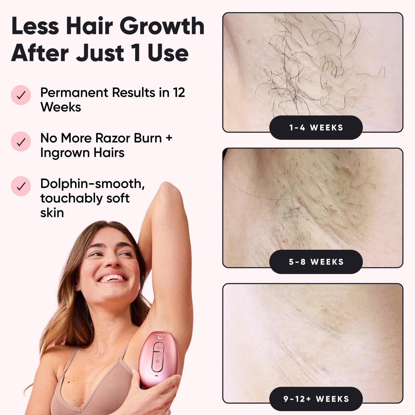 RoseSkinCo Lumi IPL Laser Hair Removal Device, At Home Permanent Hair Reduction on Face, Bikini, Legs, Arms, Underarms, Safe & Gentle Intense Pulsed Beauty and Personal Care RoseSkinCo
