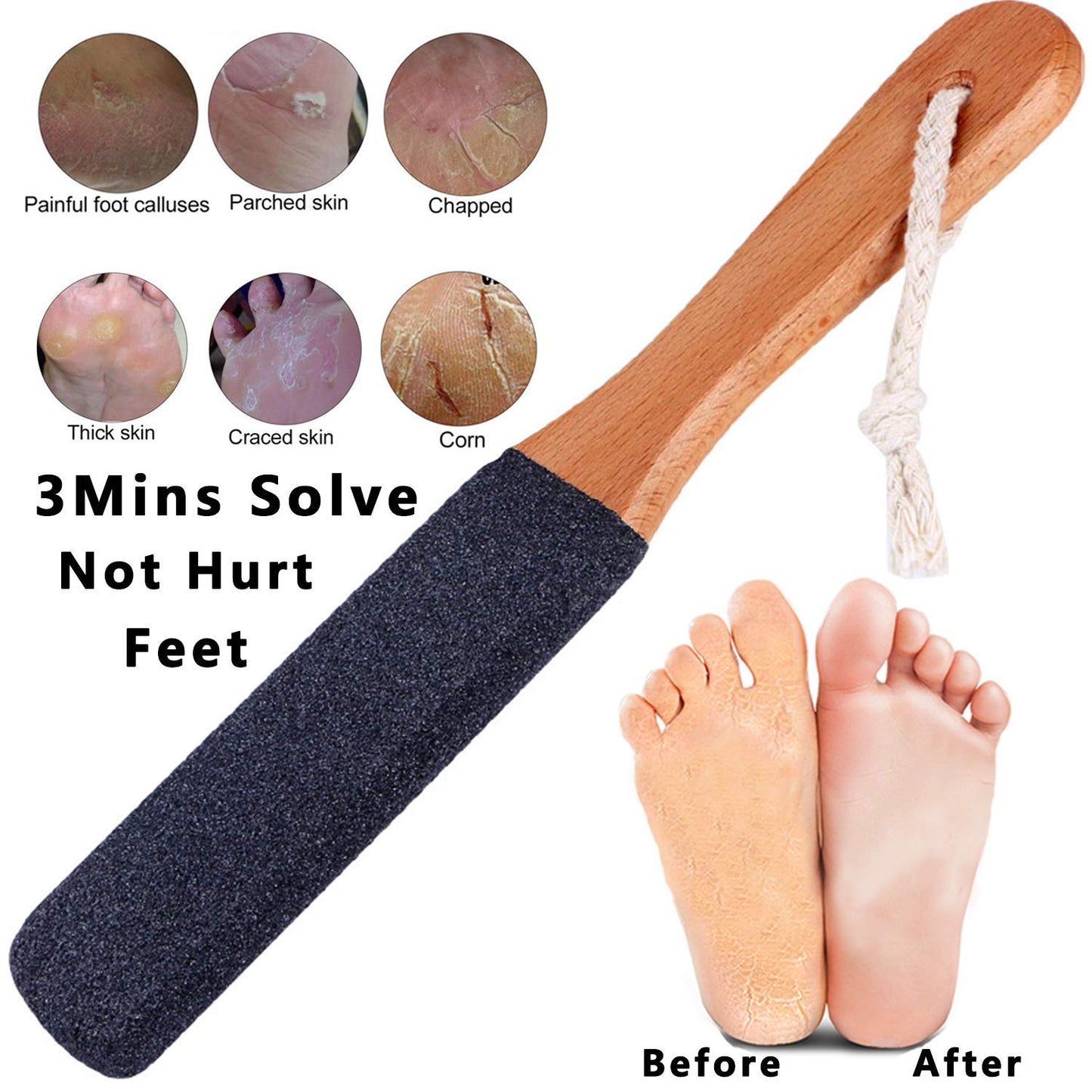 Kinepi Foot File Callus Remover Foot Scrubber,Professional Pedicure Foot Rasp Removes Cracked Heels,Dead Skin,Corn,Hard Skin,Pumice Stone for Scraper Beauty & Personal Care Kinepi